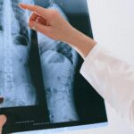 Zweitmeinung zur Wirbelsäule